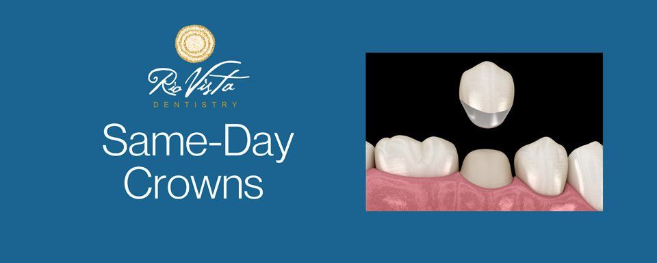 Same Day Crowns poster image