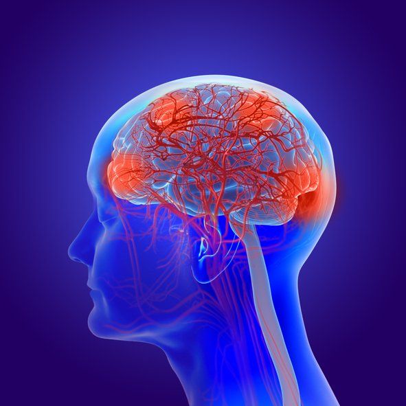 Illustration of Human Brain with Dementia — Bayonne, NJ — Neurology Partners of Hudson County, PA