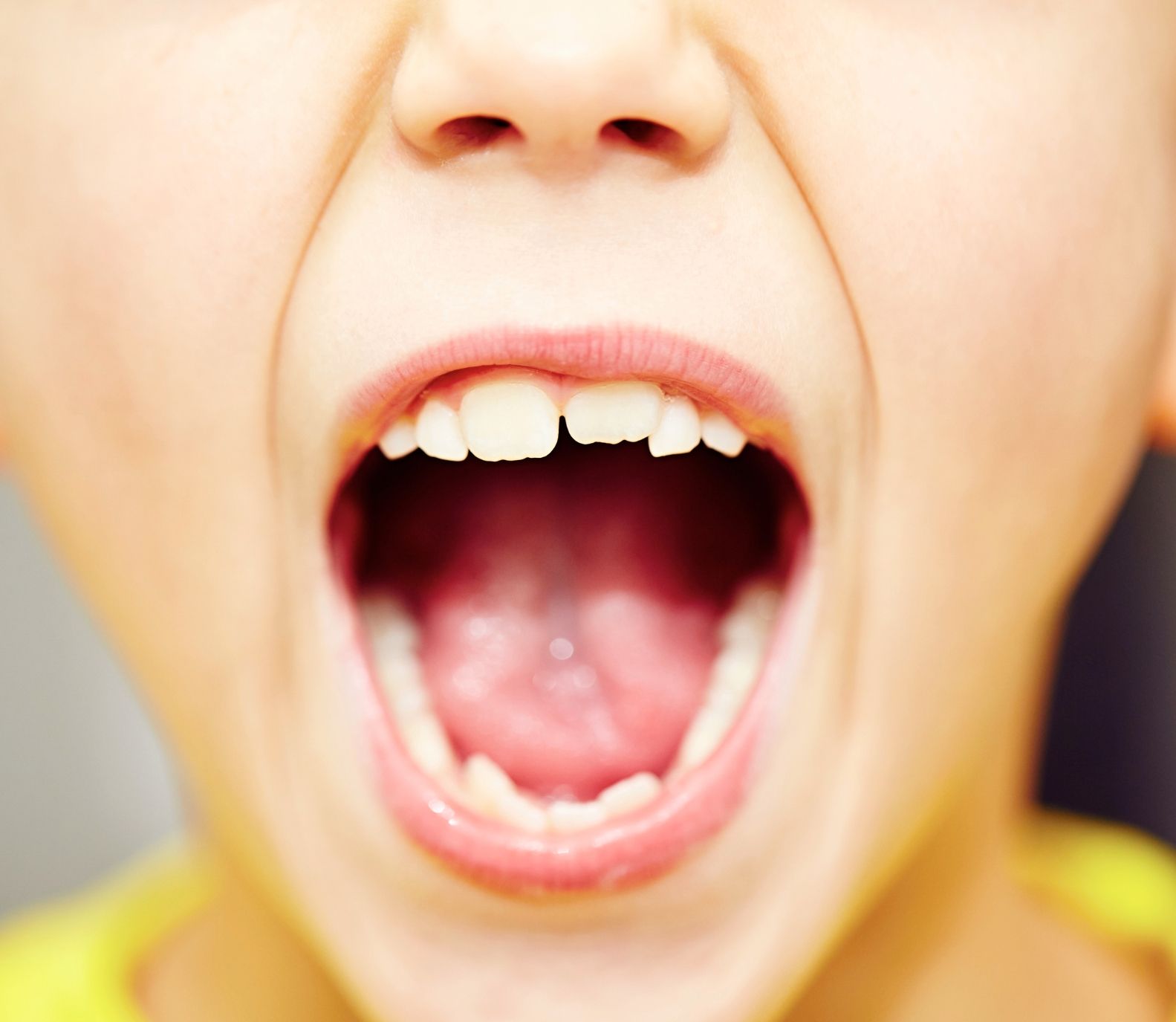 Kiddsmiles  Pediatric Dentistry Treatments- Dental Sealants, Floral Park, white plains, westchester, manhasset, merrick, holbrook, syosset, port jefferson station, north babylon, nassau county, suffolk county