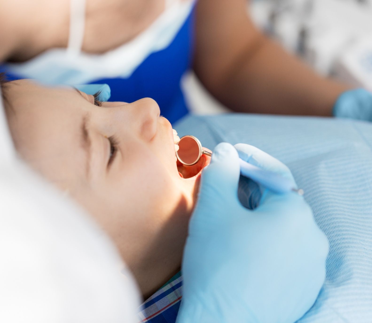 Kiddsmiles  Pediatric Dentistry Treatments- Dental Sealants, Floral Park, white plains, westchester, manhasset, merrick, holbrook, syosset, port jefferson station, north babylon, nassau county, suffolk county