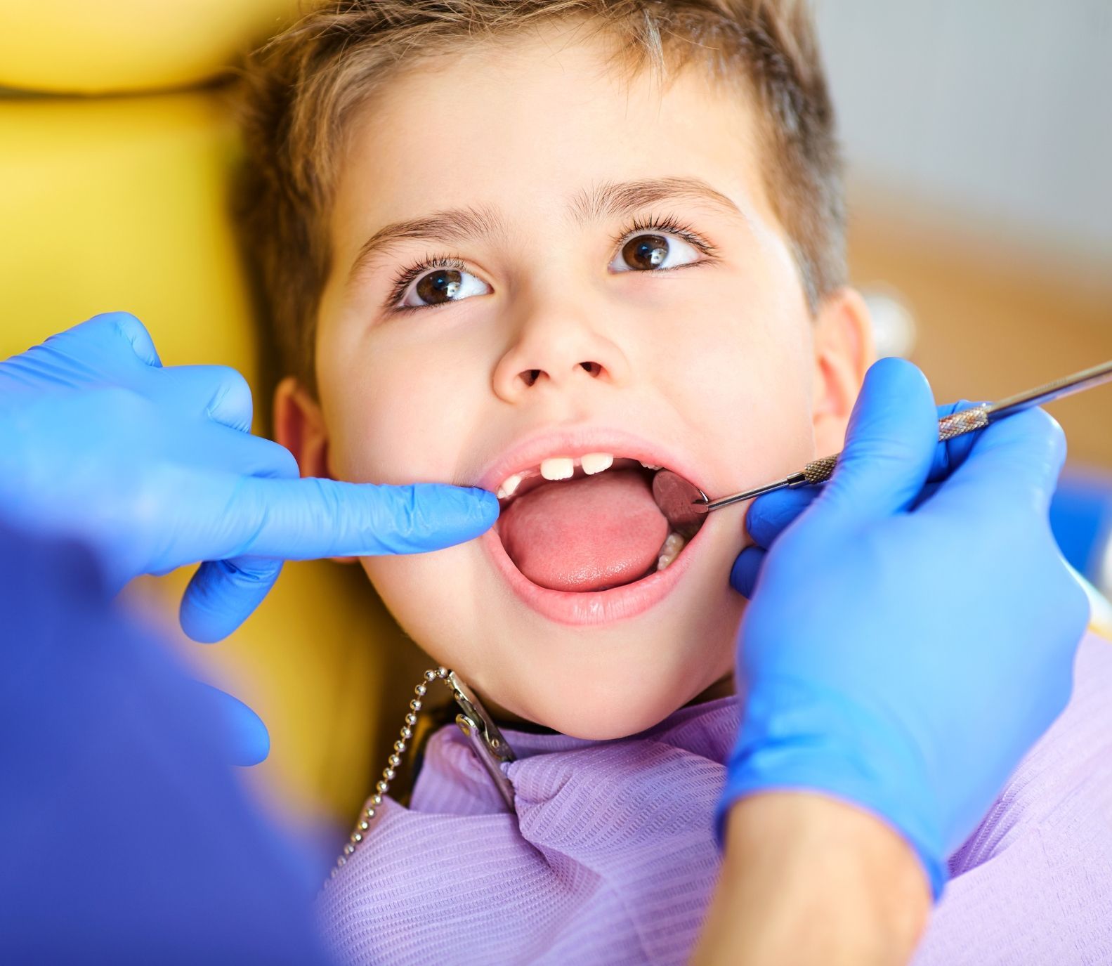 Kiddsmiles  Pediatric Dentistry Frenectomies, Floral Park, white plains, westchester, manhasset, merrick, holbrook, syosset, port jefferson station, north babylon, nassau county, suffolk county