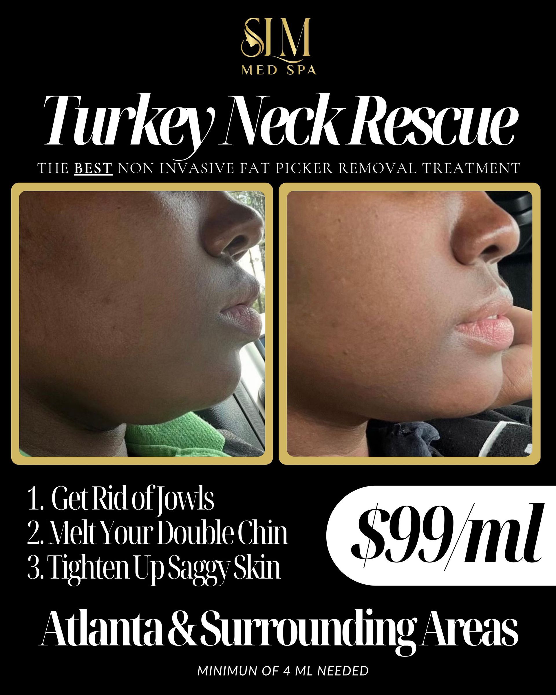 a before and after photo of a turkey neck rescue treatment