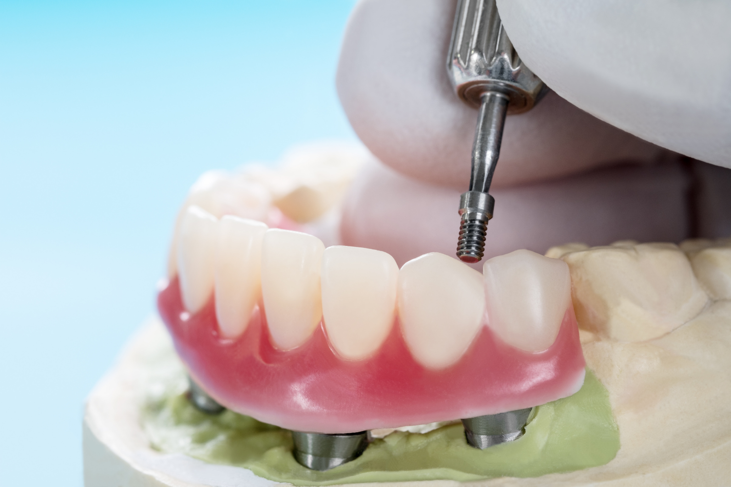 Dentist adjusting a pink dental prosthesis on a model with a handheld tool