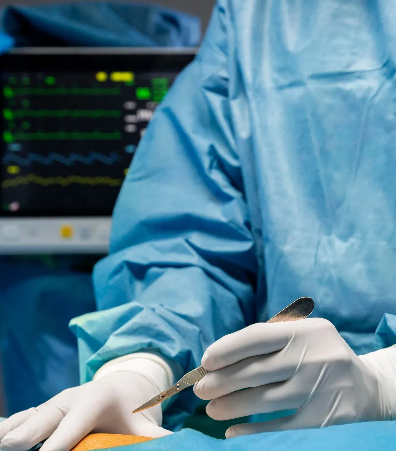 Chirurgie urologique