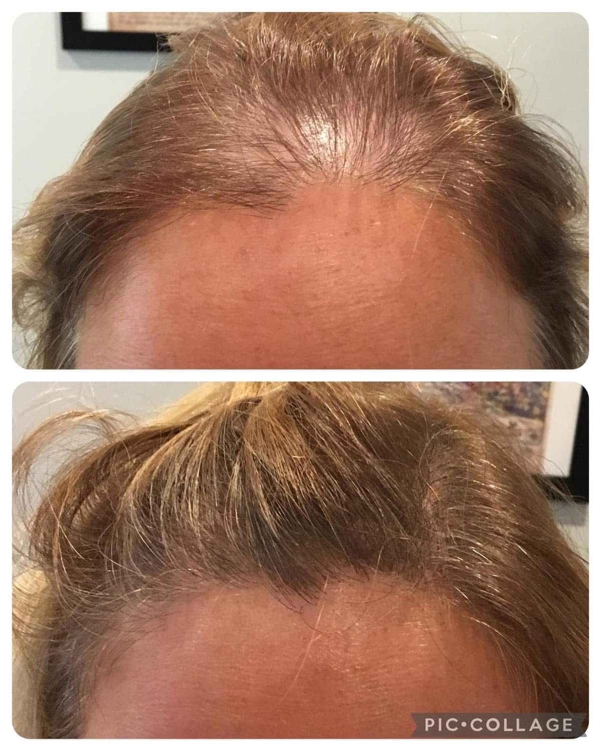 A before and after photo of a woman 's hair growth.