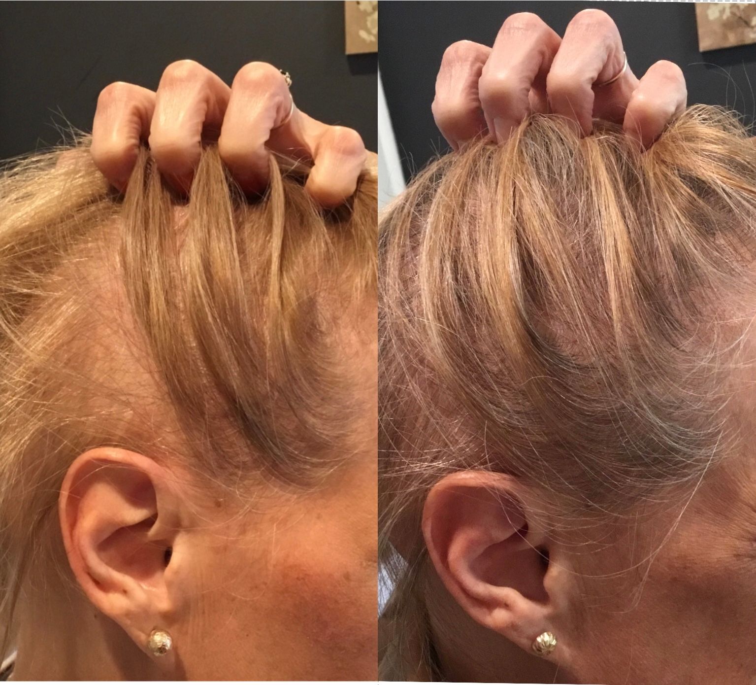 A woman 's hair is shown before and after being braided