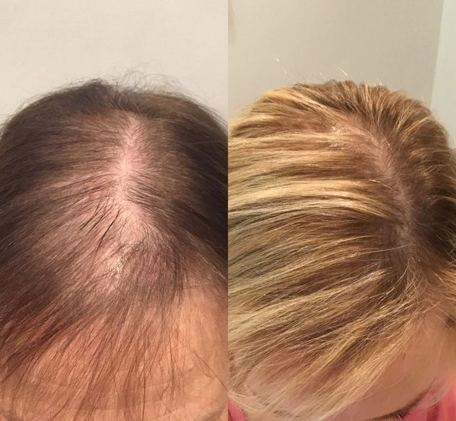 A before and after photo of a woman 's hair