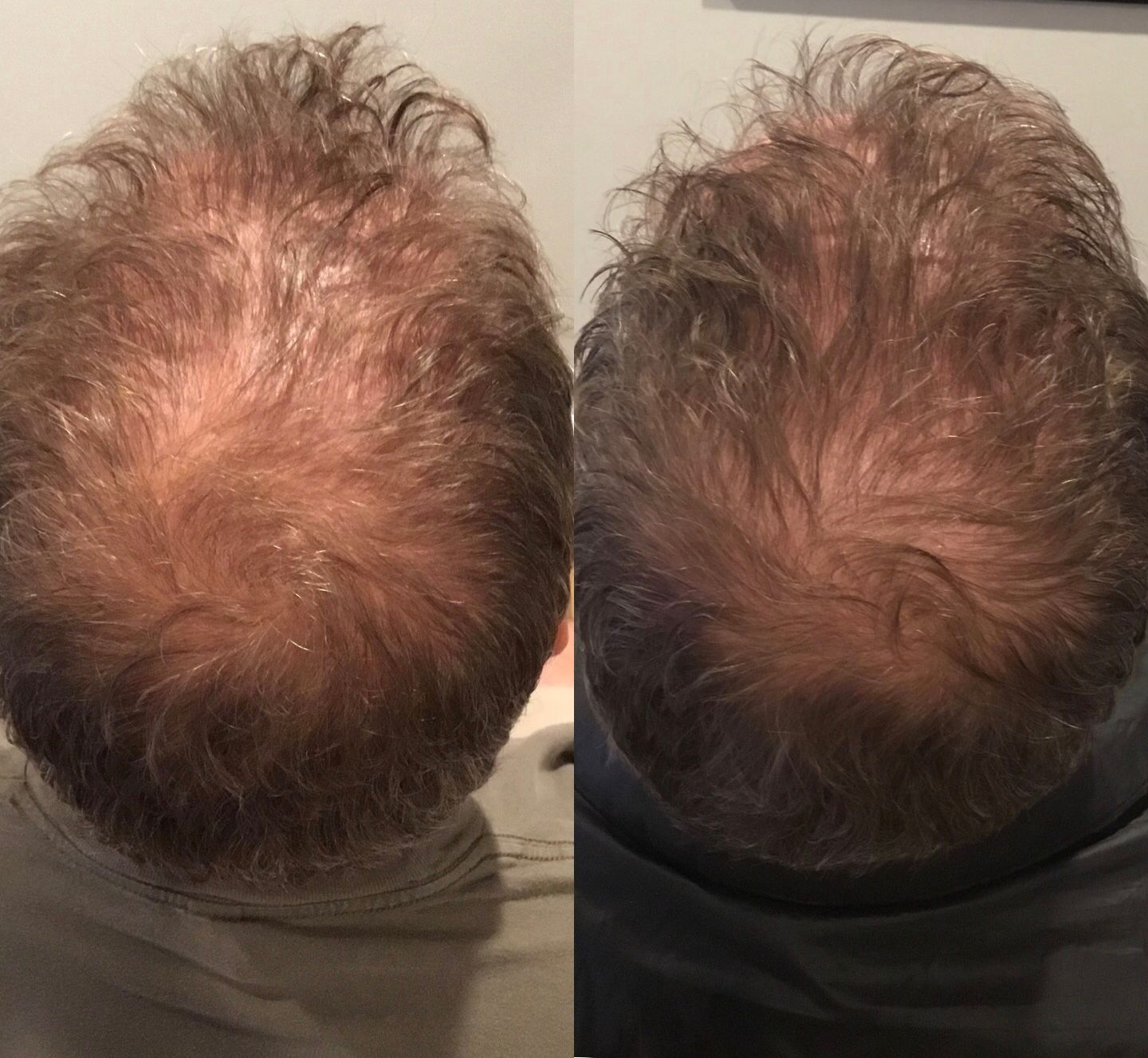 A before and after picture of a man 's hair