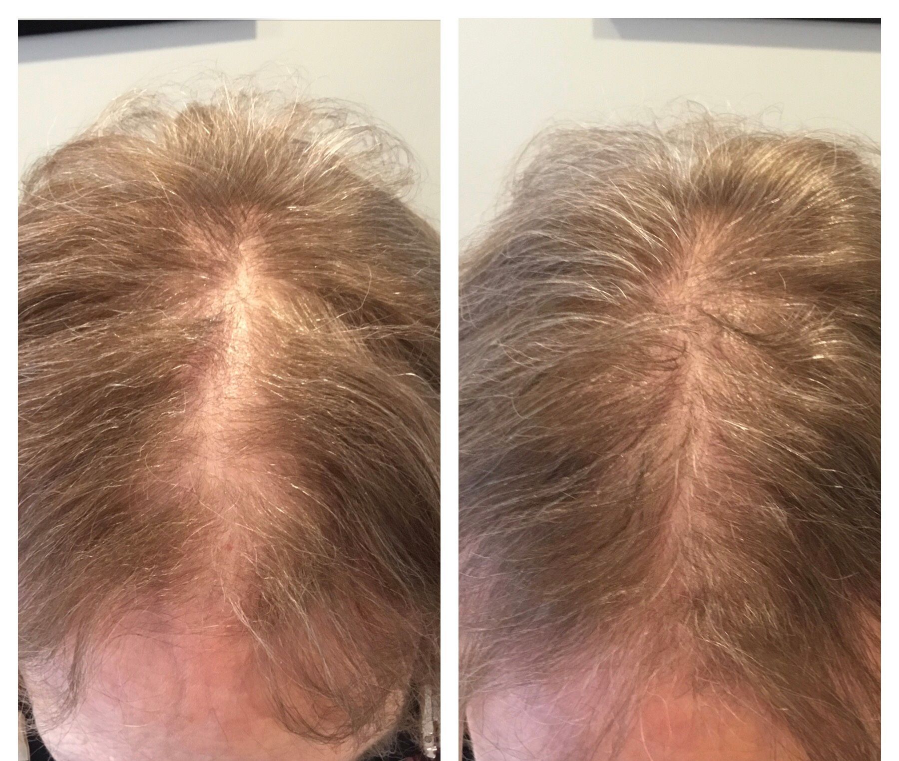 A before and after photo of a woman 's hair.