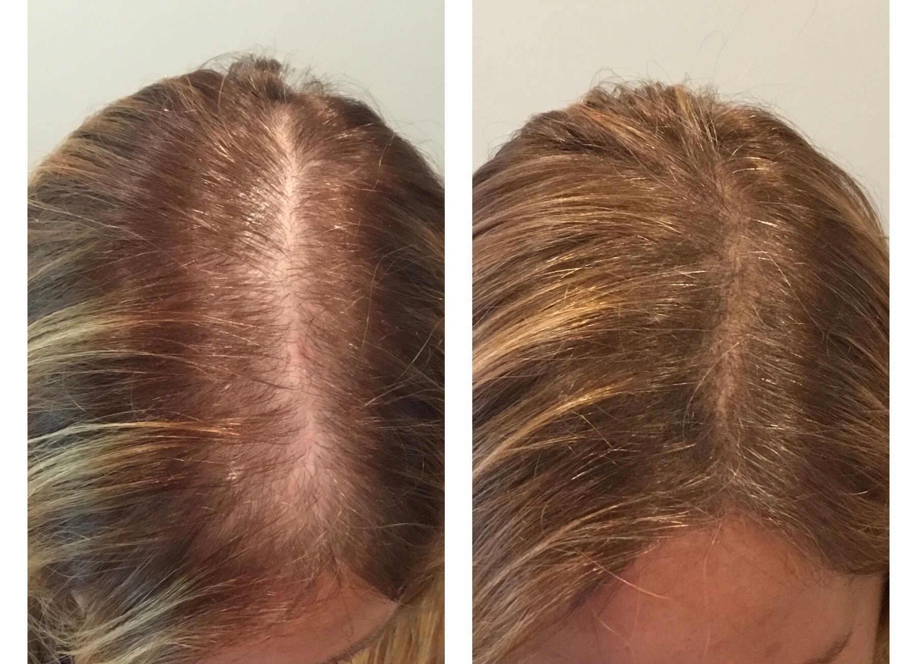 A before and after photo of a woman 's hair.