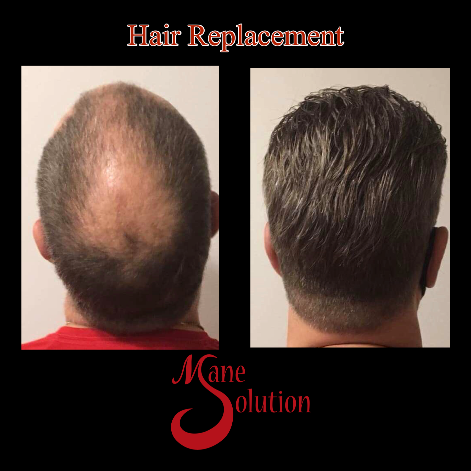 A before and after picture of a man 's hair replacement