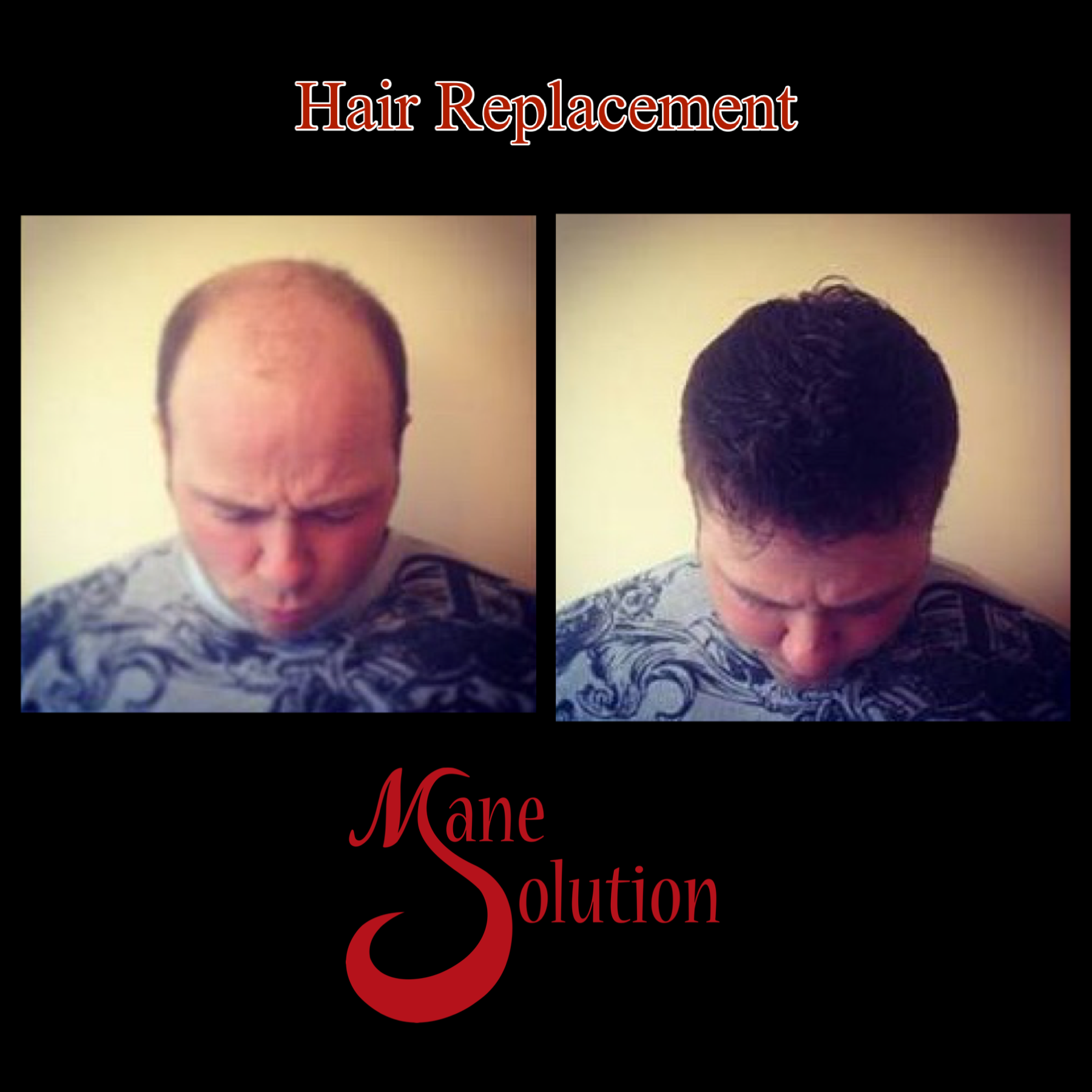 A picture of a man before and after hair replacement