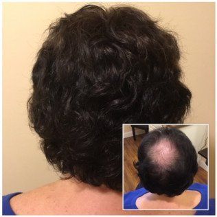 The back of a woman 's head with a before and after picture of her hair.