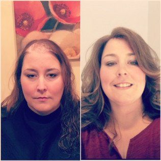 A before and after photo of a woman 's hair.