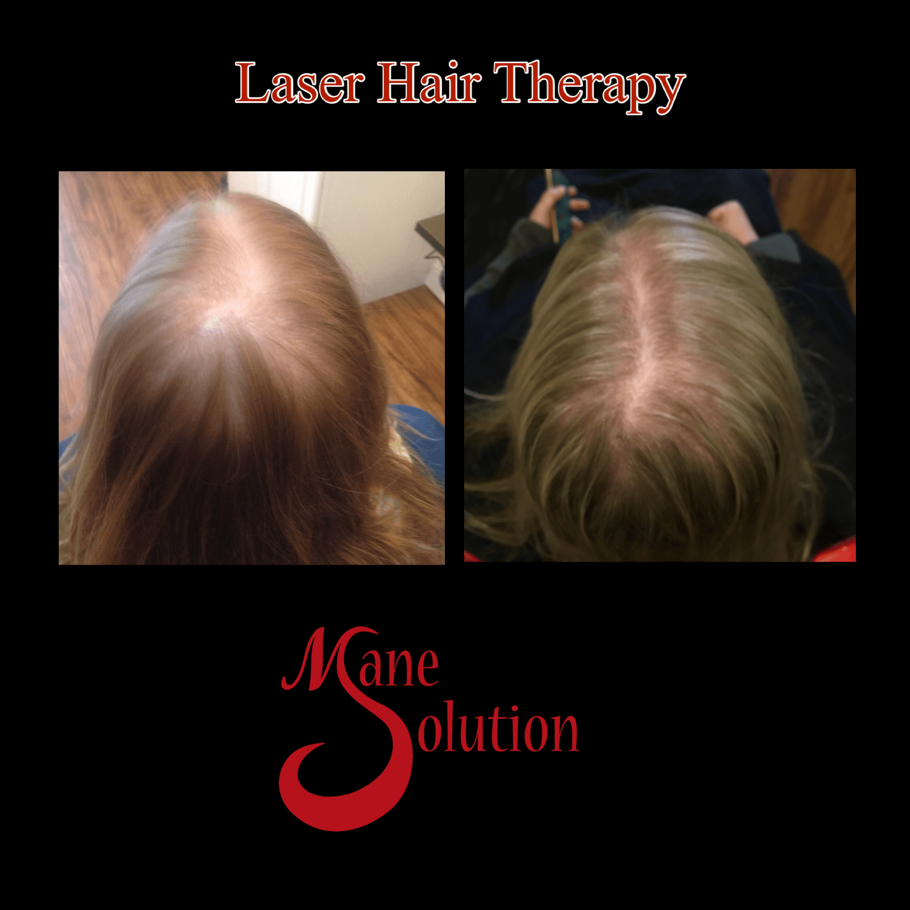 A picture of a woman 's hair before and after laser hair therapy