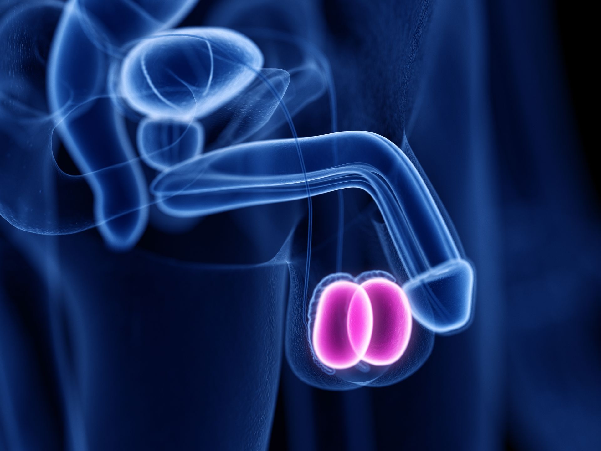 Quando a cirurgia para hidrocele é recomendada?