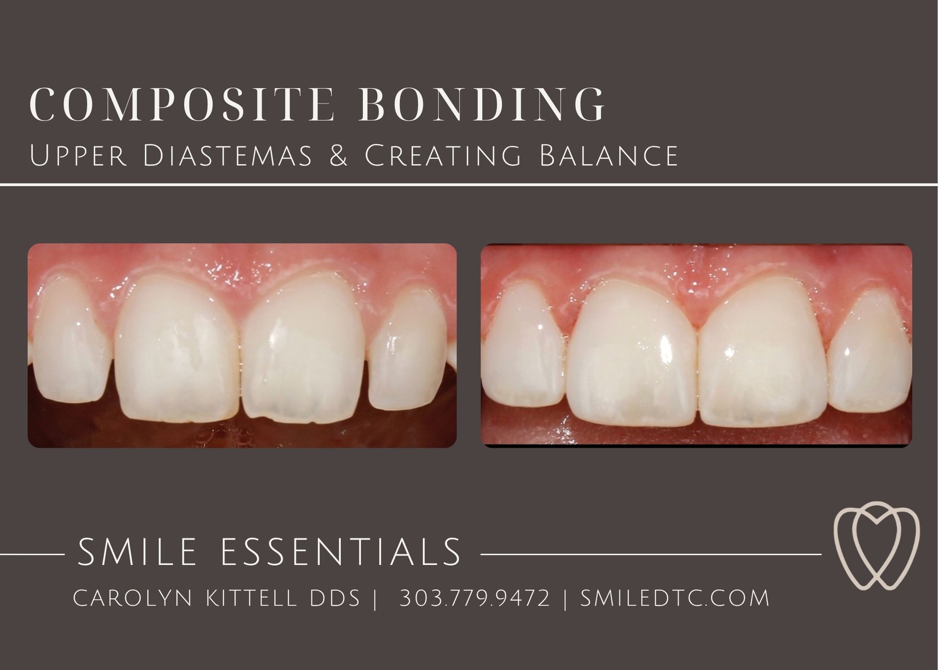 Composite bonding is shown on a pink background