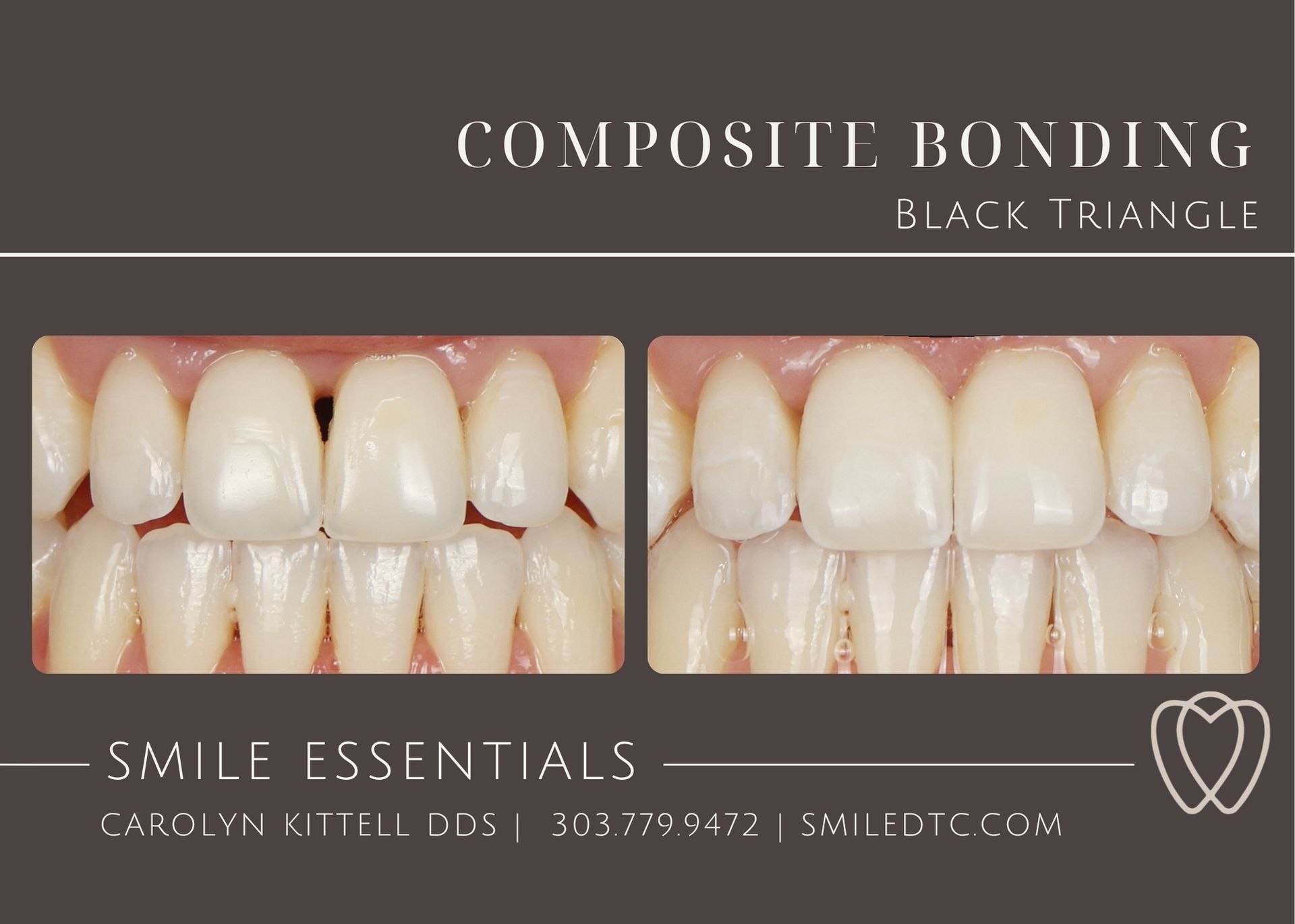 close black triangle