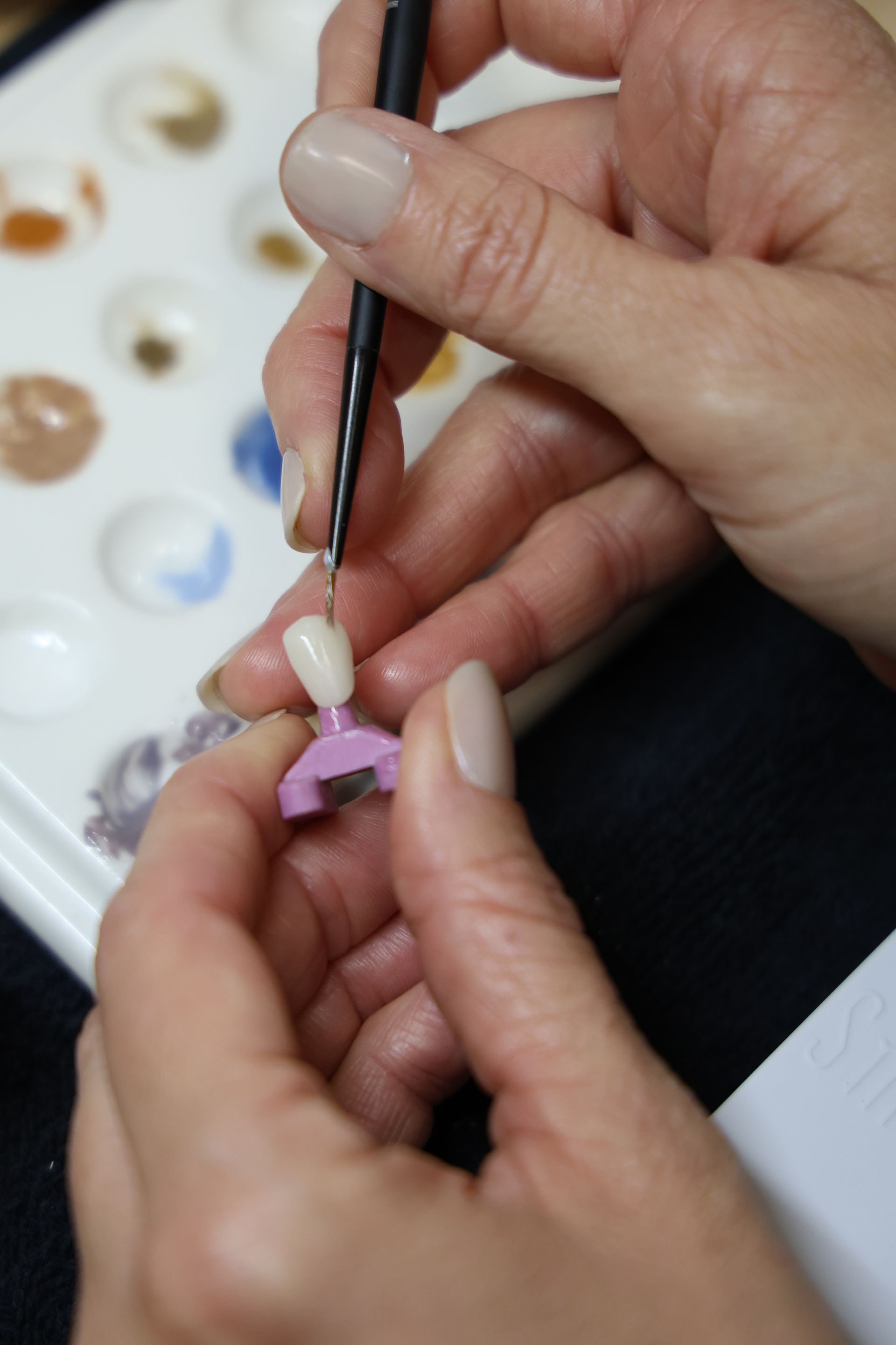 denver cosmetic dentistry artist