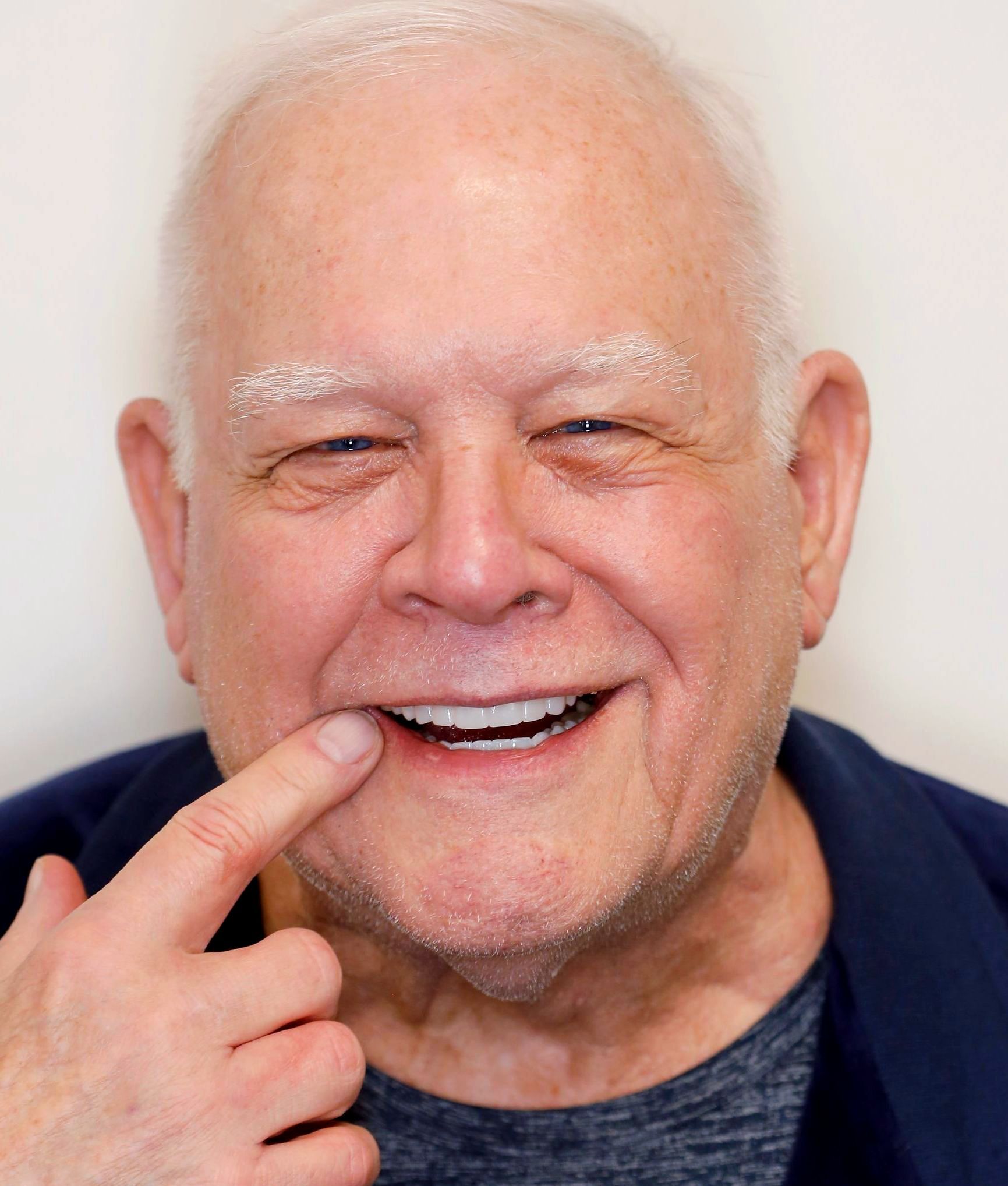 older man with a restored smile in denver