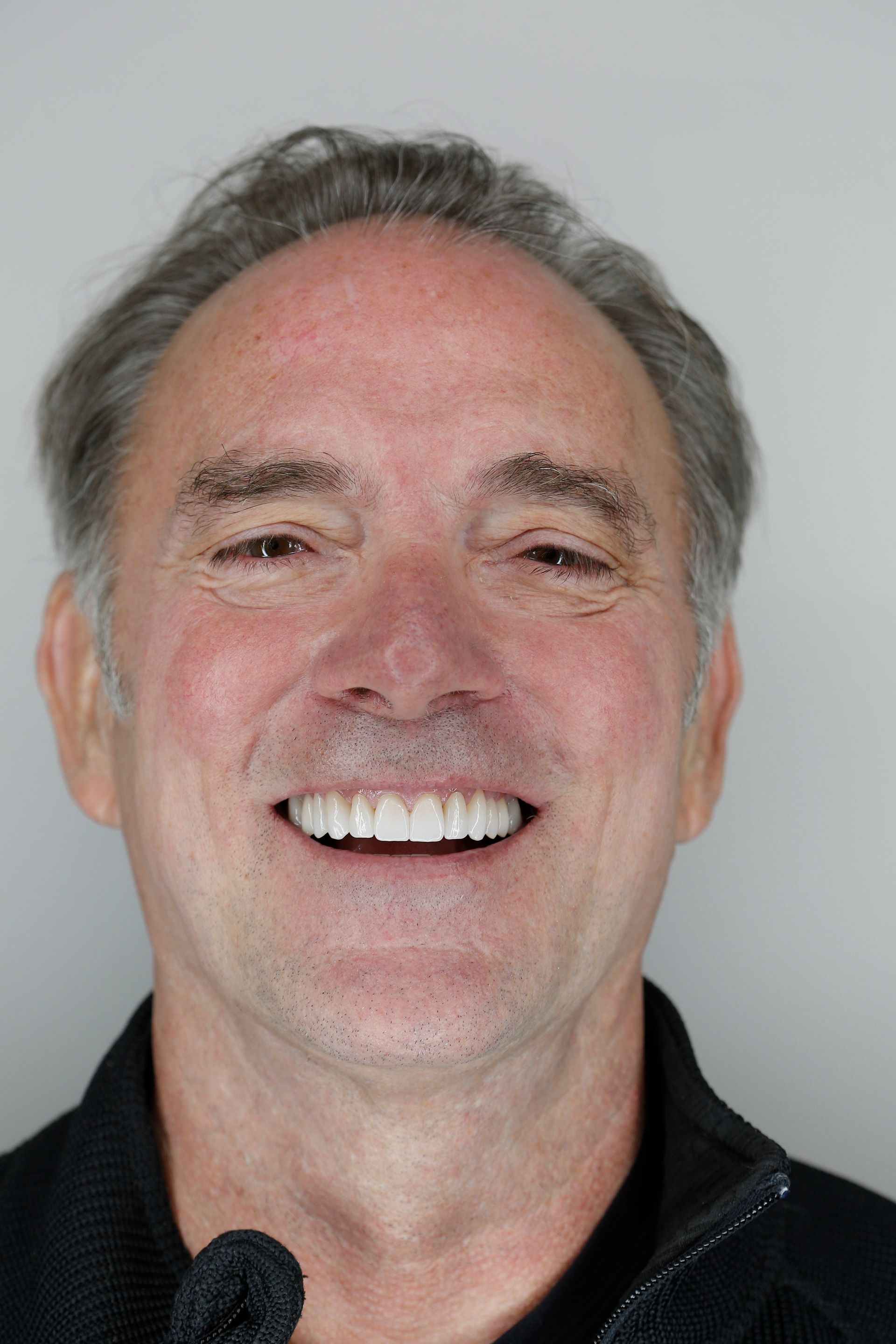 A reconstructed smile