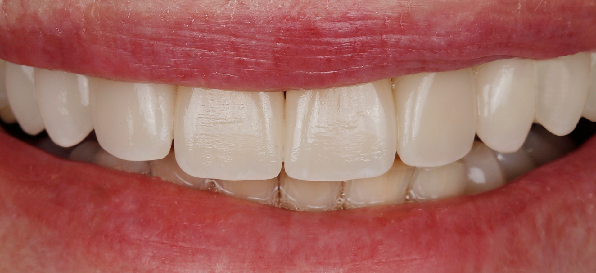 A reconstructed smile