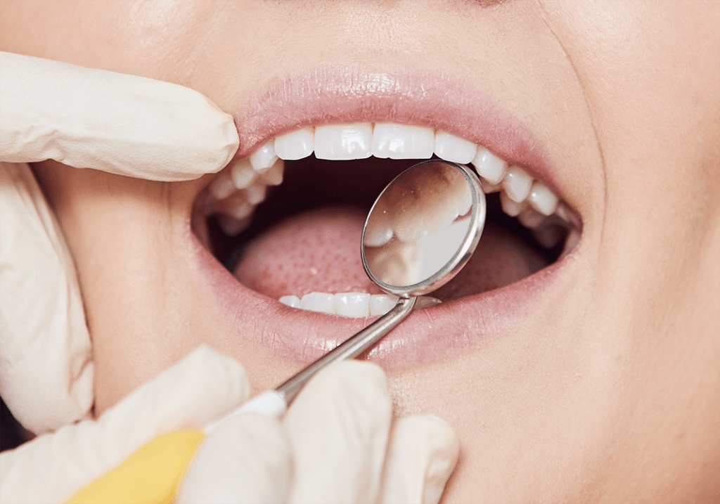 Сайт стоматологии. Clean smile. Clean smile. Clean smile. Clean smile.