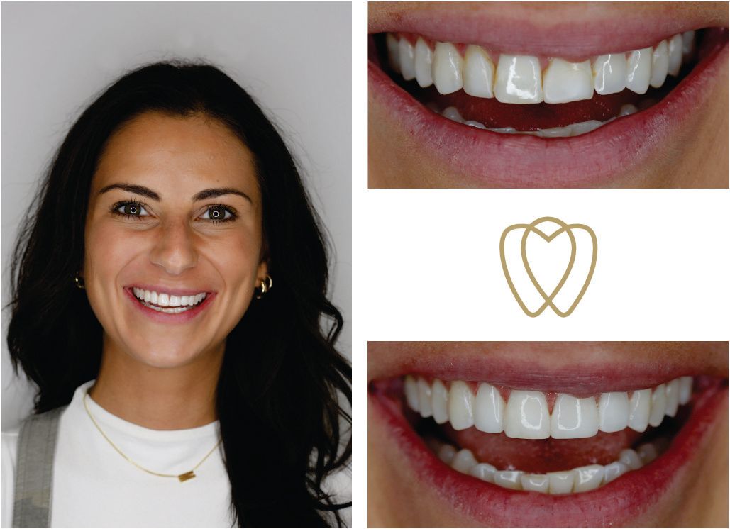 A woman is smiling in front of a picture of her teeth