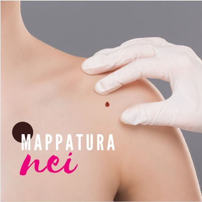 La mano guantata di un medico esamina un neo sulla spalla di una persona. Testo: 