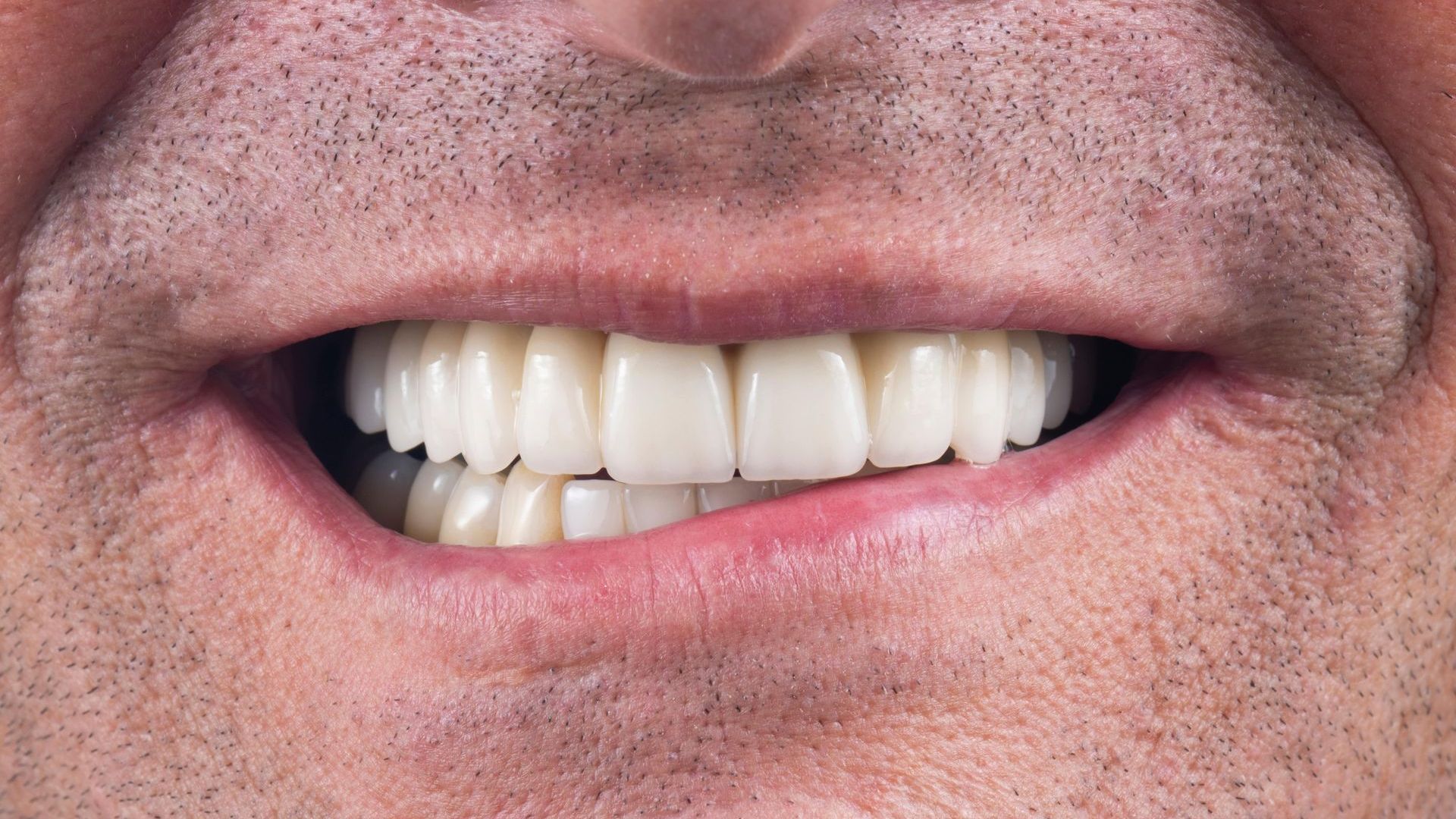 A close up of a man 's mouth with white teeth.