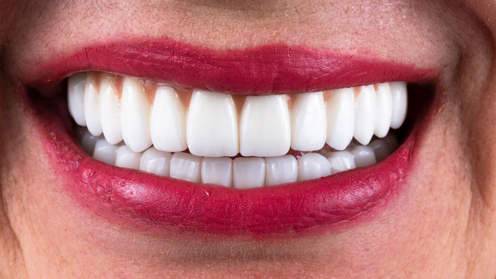 A close up of a woman 's smile with white teeth and red lipstick.