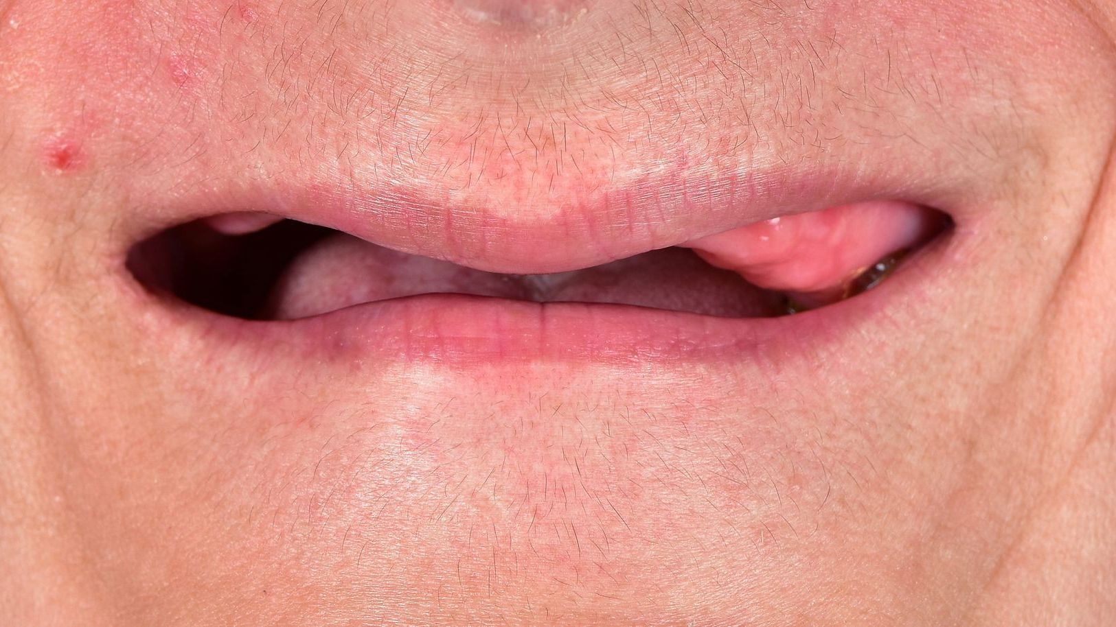 A close up of a woman 's mouth with no teeth.