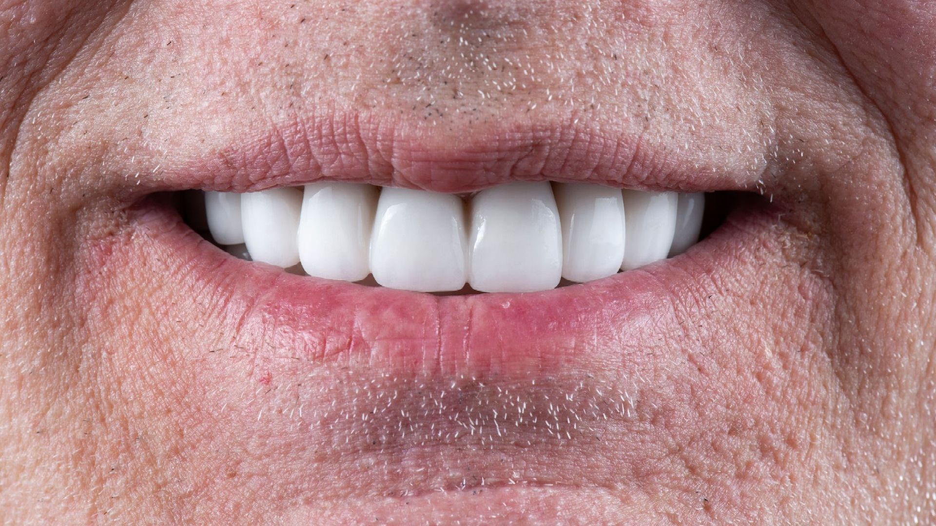 A close up of a man 's mouth with white teeth.