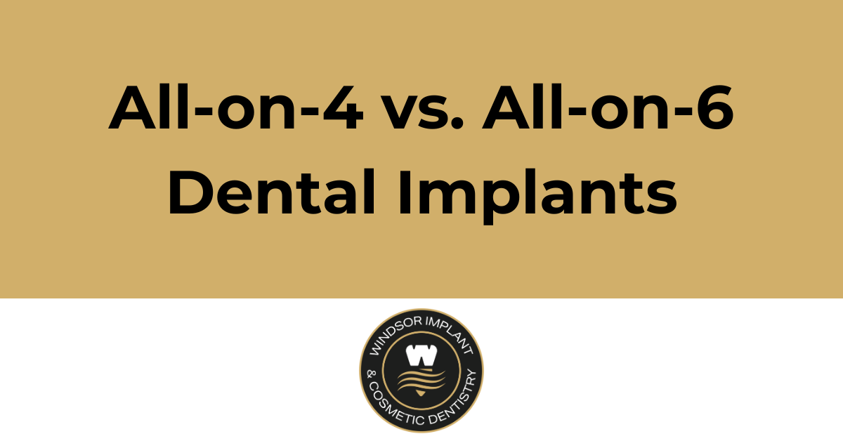 Windsor Dentistry : All-on-4 vs. All-on-6 Dental Implants