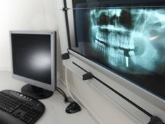 radiologia dentale