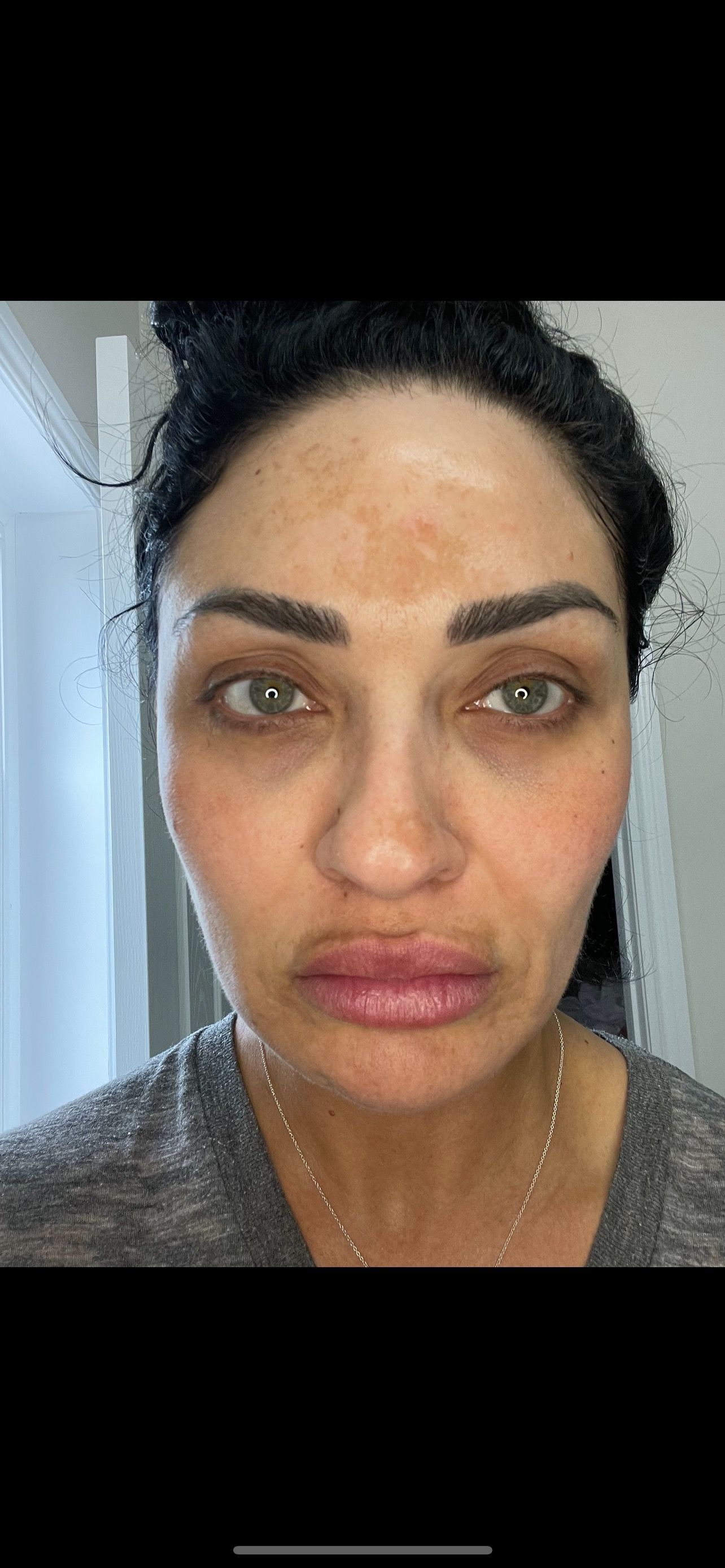 A close up of a woman 's face without makeup.