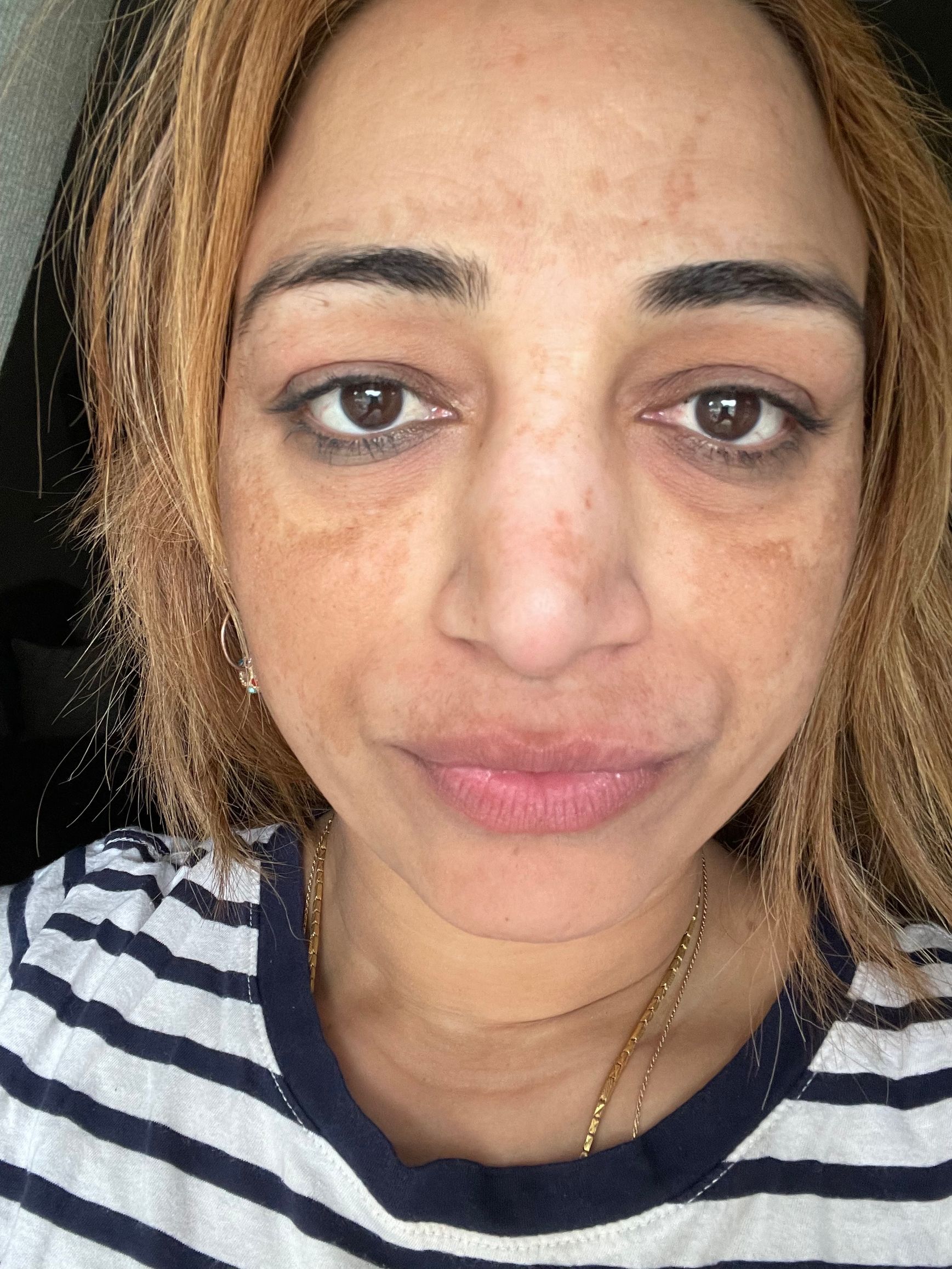A close up of a woman 's face wearing a striped shirt.