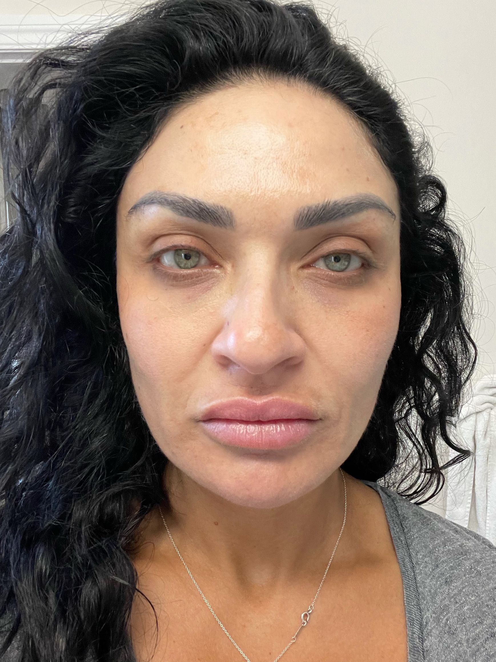 A close up of a woman 's face without makeup.