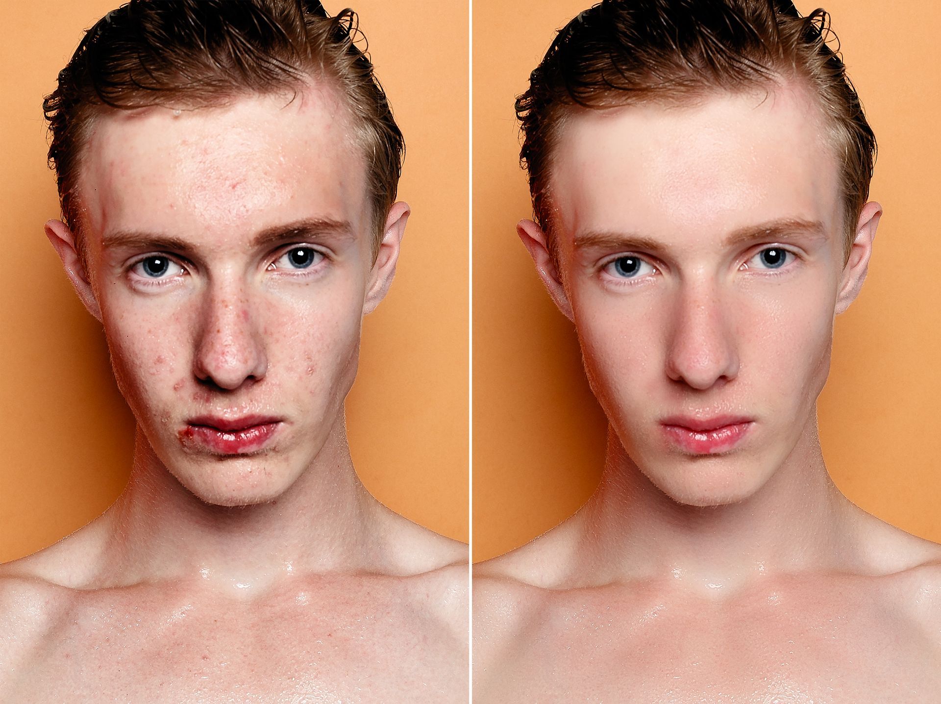 Comparison of a person's face before and after skin retouching.