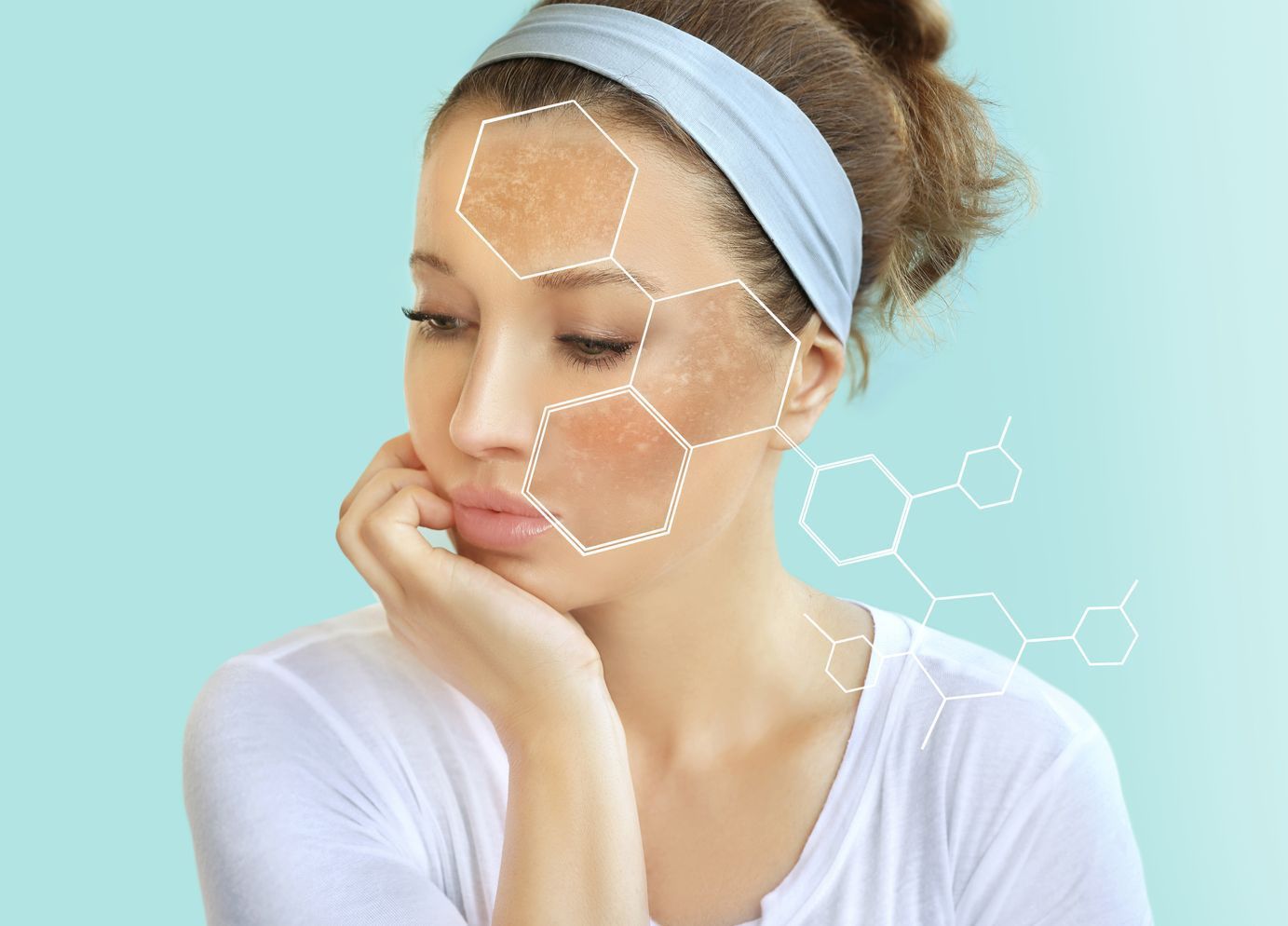 A woman with a headband on her head has spots on her face.