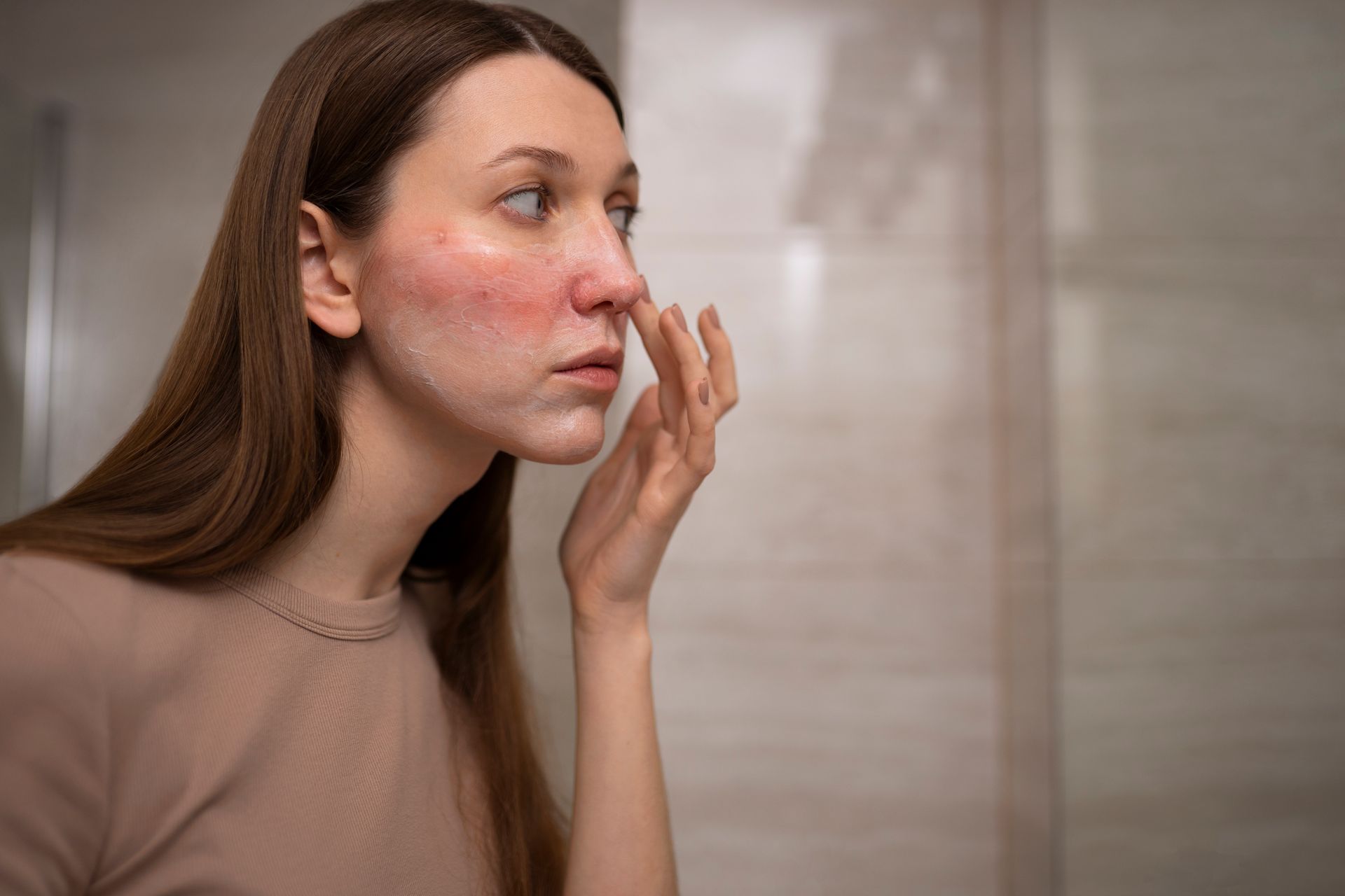 Woman looking in mirror, touching face with visible redness and irritation.