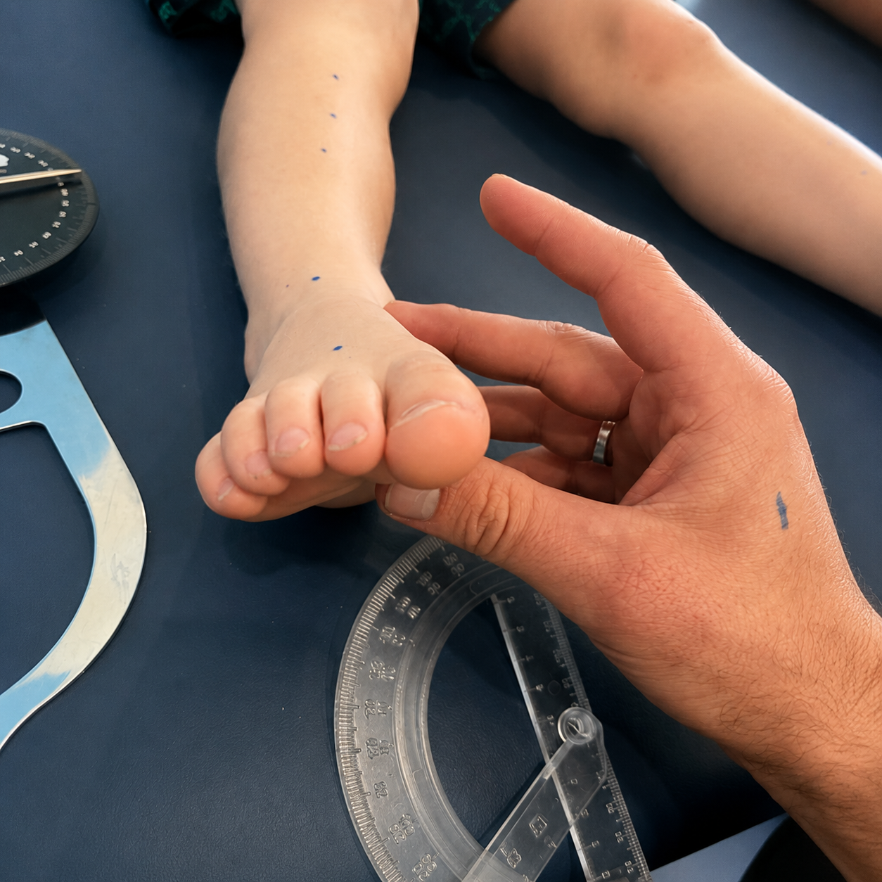 Child’s Bare Feet Being Examined With a Hand — Lord Street Podiatry in Port Macquarie, NSW