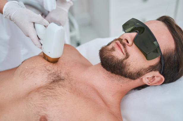 A man is getting a laser hair removal treatment on his chest.