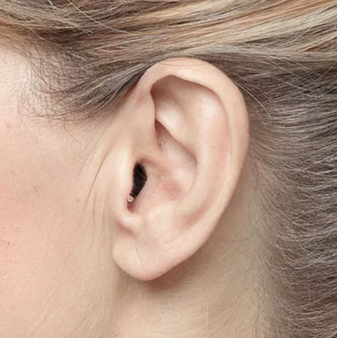 apparecchi acustici intrauricolari