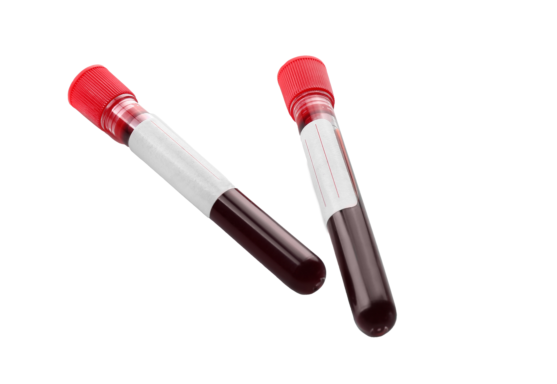 Two blood sample tubes with red caps and white labels, filled with dark red blood.