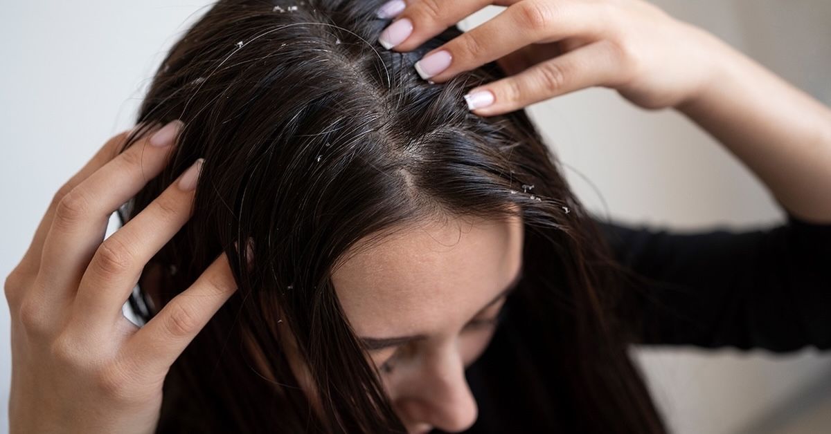 How Can You Protect Your Hair from Winter Frizz and Breakage?