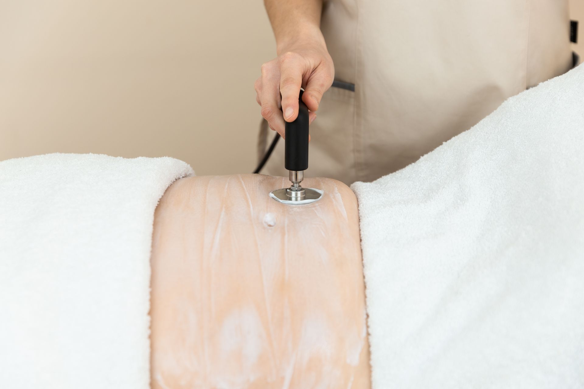 Post-surgery radio-frequency San Francisco, radio-frequency for pain San Francisco, radio frequency for swelling San Francisco, radio frequency post liposuction san Francisco Bay Area, indiba san francsico california