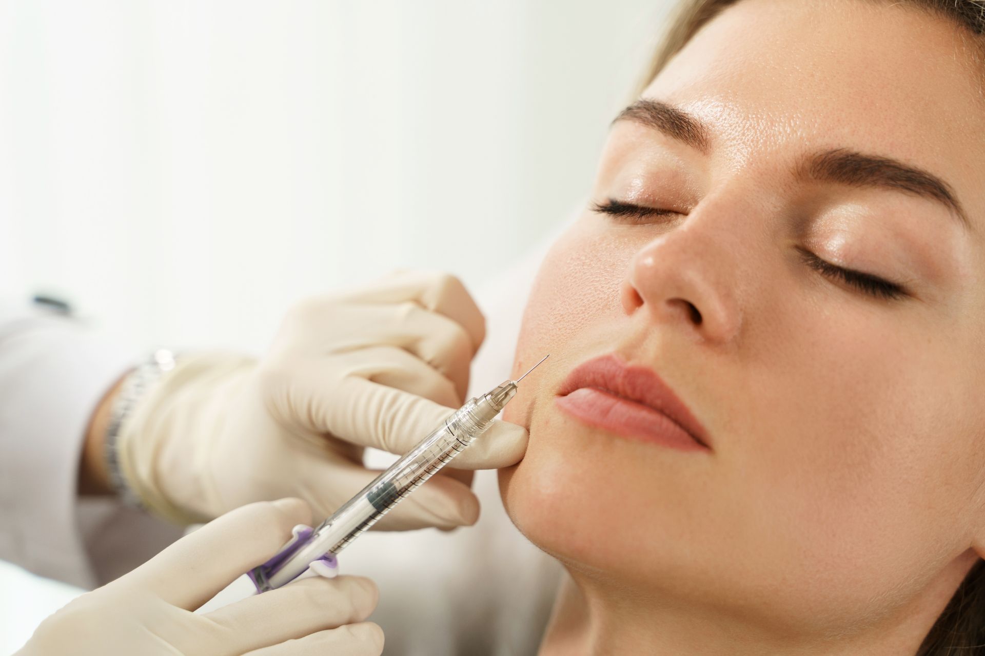 A professional using a syringe to inject a cosmetic filler into the skin near a patient's mouth.