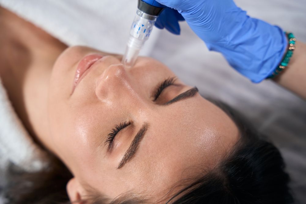 A woman getting microneedling on her face. A gloved hand holds the device, eyes closed.