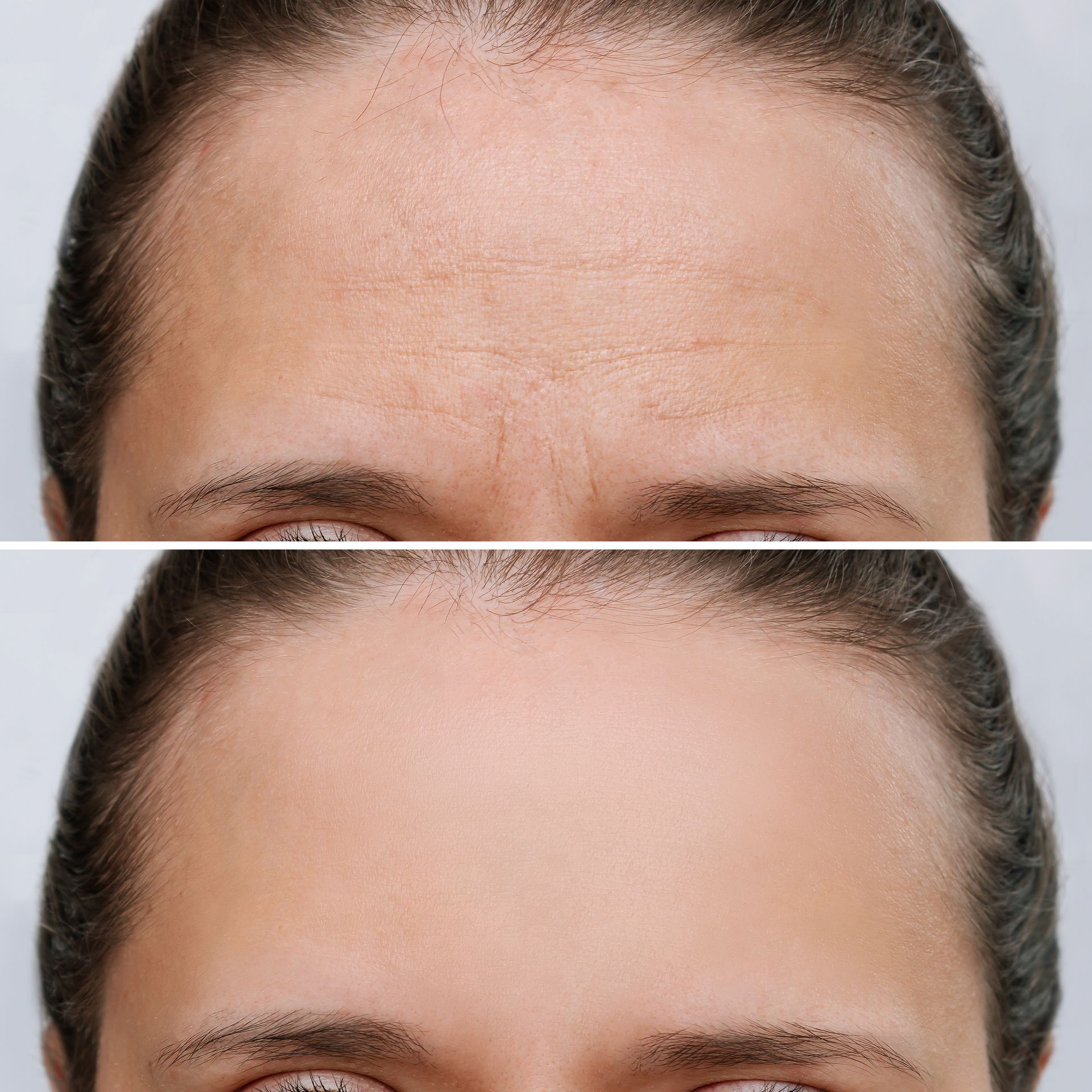 A before and after photo of a man 's forehead.